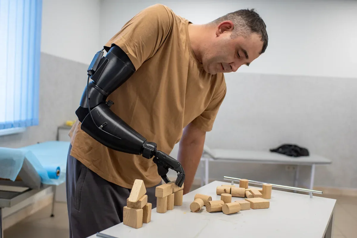 Person with a prosthetic arm interacting with wooden blocks on a table.